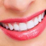 Top 8 Sản phẩm giúp tẩy trắng răng, cho bạn nụ cười trắng sáng tốt nhất