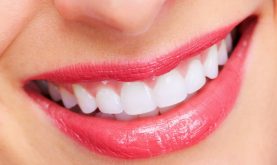 Top 8 Sản phẩm giúp tẩy trắng răng, cho bạn nụ cười trắng sáng tốt nhất