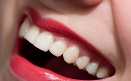 Top 8 địa chỉ bọc răng sứ đẹp và an toàn nhất tại Tp HCM