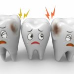 Top 9 Kem đánh răng đặc trị ngừa sâu răng hiệu quả nhất hiện nay