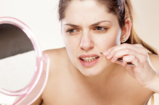 Thắc Mắc: "Da Mặt Phụ Nữ Nhiều Lông Phải Làm Sao?"